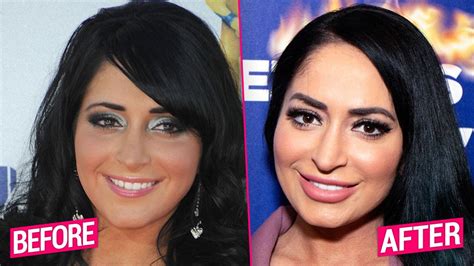 angelina pivarnick acne|Jersey Shore: All of Angelina Plastic Surgery Procedures